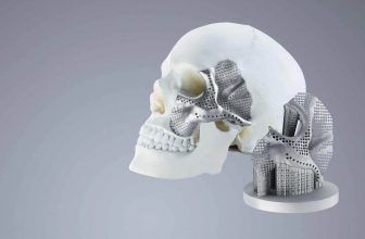 11 Things We Can 3D Print in Medicine Right Now